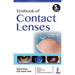 Textbook of Contact Lenses