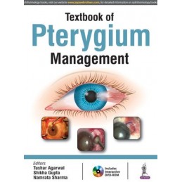 Textbook of Pterygium Management