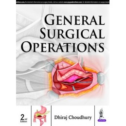 General Surgical Operations