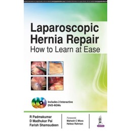 Laparoscopic Hernia Repair:...