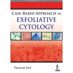 Case Based Approach in...