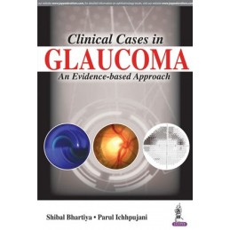 Clinical Cases in Glaucoma:...