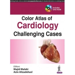 Color Atlas of Cardiology:...