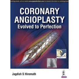 Coronary Angioplasty:...