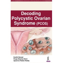 Decoding Polycystic Ovarian...