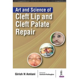 Art and Science of Cleft Lip and Cleft Palate Repair