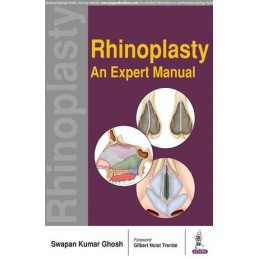 Rhinoplasty: An Expert Manual