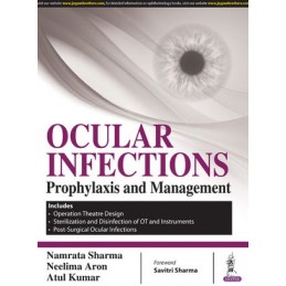 Ocular Infections: Prophylaxis and Management