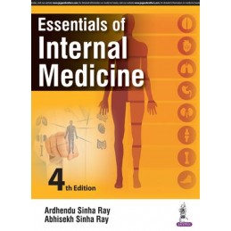 Essentials of Internal...