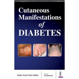 Cutaneous Manifestations of...