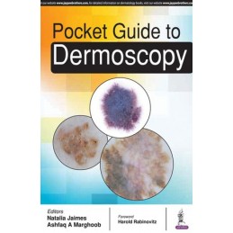 Pocket Guide to Dermoscopy