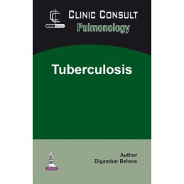 Clinic Consult Pulmonology: Tuberculosis