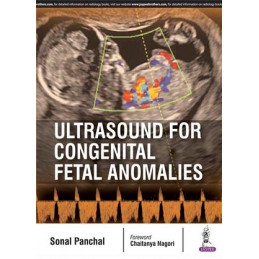 Ultrasound for Congenital...