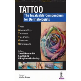 TATTOO - The Invaluable Compendium for Dermatologists