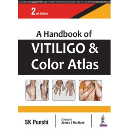 A Handbook of Vitiligo &...