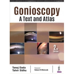 Gonioscopy: A Text and Atlas