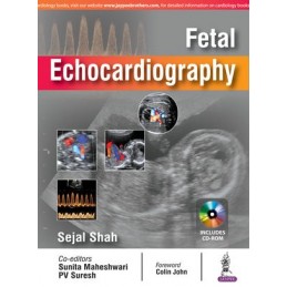 Fetal Echocardiography