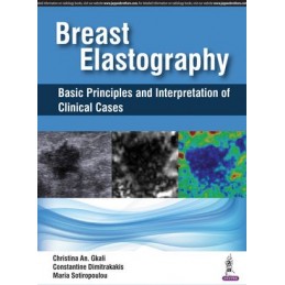 Breast Elastography: Basic...