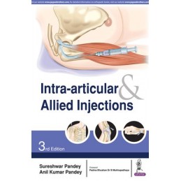 Intra-articular & Allied...