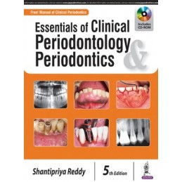 Essentials of Clinical Periodontology & Periodontics