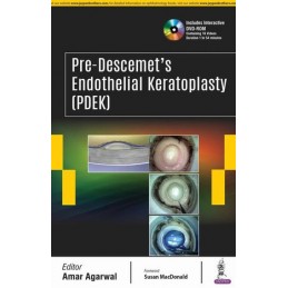 Pre-Descemet's Endothelial Keratoplasty (PDEK)