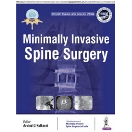 Minimally Invasive Spine...