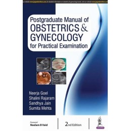 Postgraduate Manual of Obstetrics & Gynecology for Practical Examination