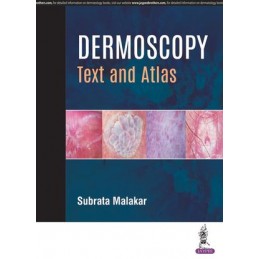 Dermoscopy: Text and Atlas