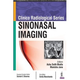 Clinico Radiological Series: Sinonasal Imaging