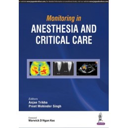 Monitoring in Anesthesia and Critical Care