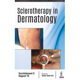 Sclerotherapy in Dermatology