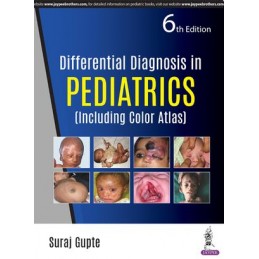 Differential Diagnosis in Pediatrics: (Including Color Atlas)