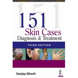 151 Skin Cases: Diagnosis &...