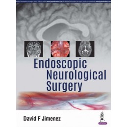 Endoscopic Neurological...