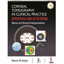 Corneal Tomography in Clinical Practice (Pentacam System): Basics & Clinical Interpretation