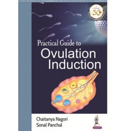 Practical Guide to Ovulation Induction