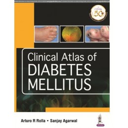 Clinical Atlas of Diabetes Mellitus