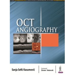 OCT Angiography