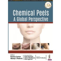 Chemical Peels: A Global...
