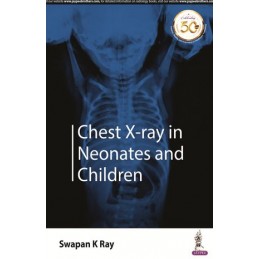 Chest X-ray in Neonates and...