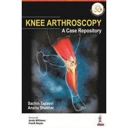Knee Arthroscopy: A Case...