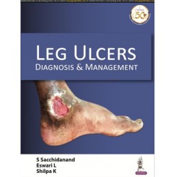 Leg Ulcers: Diagnosis &...