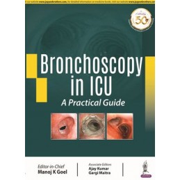 Bronchoscopy in ICU: A...