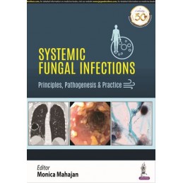 Systemic Fungal Infections:...