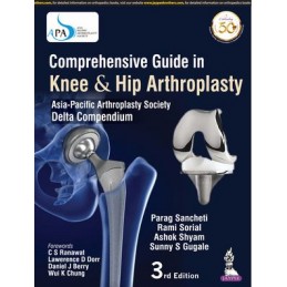 Comprehensive Guide in Knee & Hip Arthroplasty