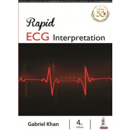 Rapid ECG Interpretation