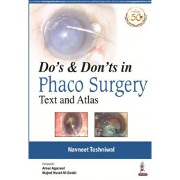 Do's & Dont's in Phaco Surgery: Text and Atlas