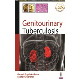 Genitourinary Tuberculosis