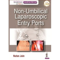 Non-Umbilical Laparoscopic...