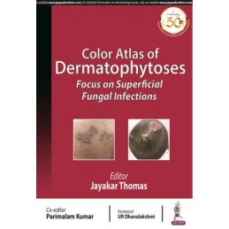 Color Atlas of Dermatophytoses: Focus on Superficial Fungal Infections